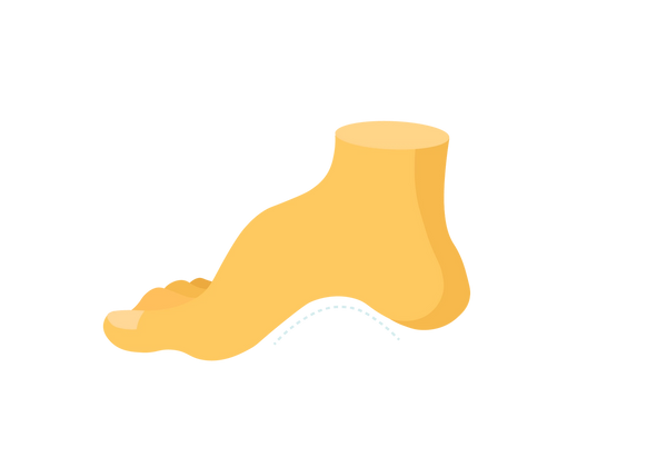 Illustration d’un pied jaune pointant vers la gauche. Il y a un arc inhabituellement haut avec une ligne pointillée bleu clair en dessous, soulignant la courbe.