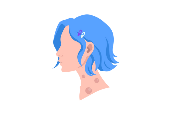 Ilustração do perfil lateral de uma mulher com caroços no pescoço. Ela tem cabelo azul curto puxado para trás com grampos roxos e verdes claros.