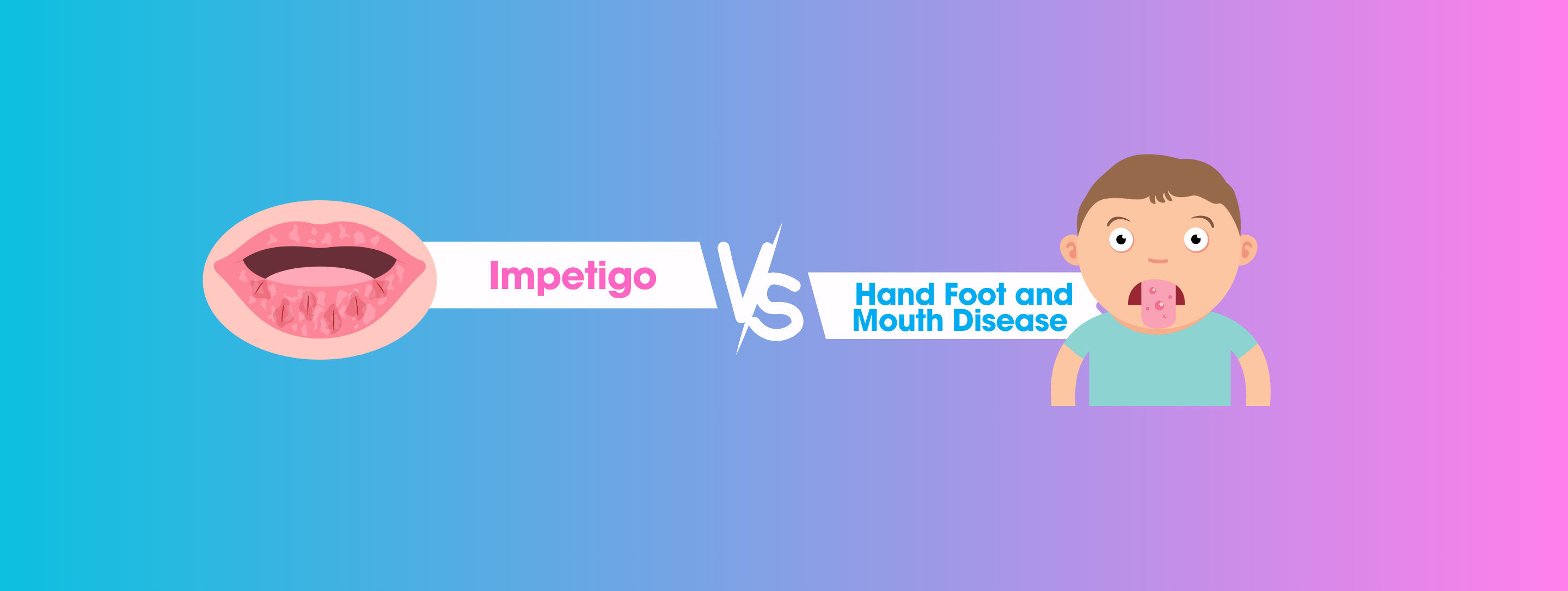 Impetigo vs. Hand Foot and Mouth Disease