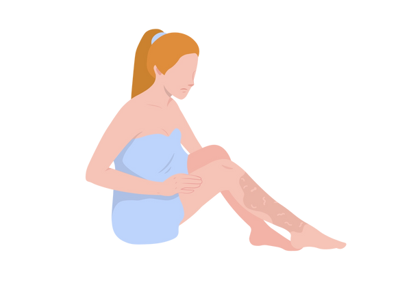 An illustration from a side profile of a woman wearing a light blue towel sitting with her legs stretched out but slightly bent in front of her. Her skin is light peach-toned and there is a darker splotch on her right calf that she is examining. The splotch has lighter squiggly lines within it. She is frowning and has one hand on her right thigh. Her light orange hair is tied up in a ponytail with a light blue hair tie.