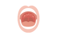 Why Do I Have Red Dots At The Top Of My Mouth Meaning Infoupdate