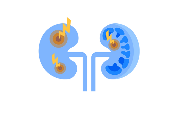 Two blue kidneys. The left one has two sets of yellow concentric circles with yellow lightning bolts emanating from each. The right has darker blue mushroom-shaped holes and another set of concentric circles with a lightning bolt.