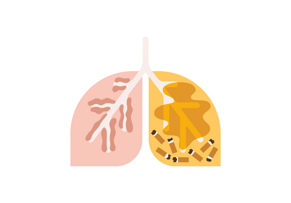 An illustration of a set of lungs, the left is pink and the right is yellow. The left has light pink veins running through it with lumpy darker pink buildup on the veins. The right lung has cigarette butts littering the bottom with a darker yellow smoke clouding the lung.