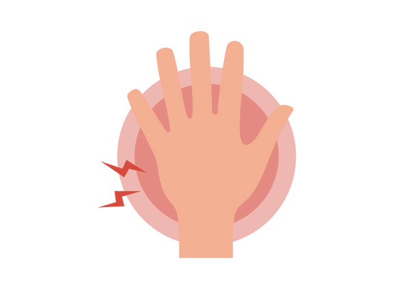 Uma mão com círculos concêntricos vermelhos irradiando por baixo dela. Dois relâmpagos vermelhos emanam do lado esquerdo.