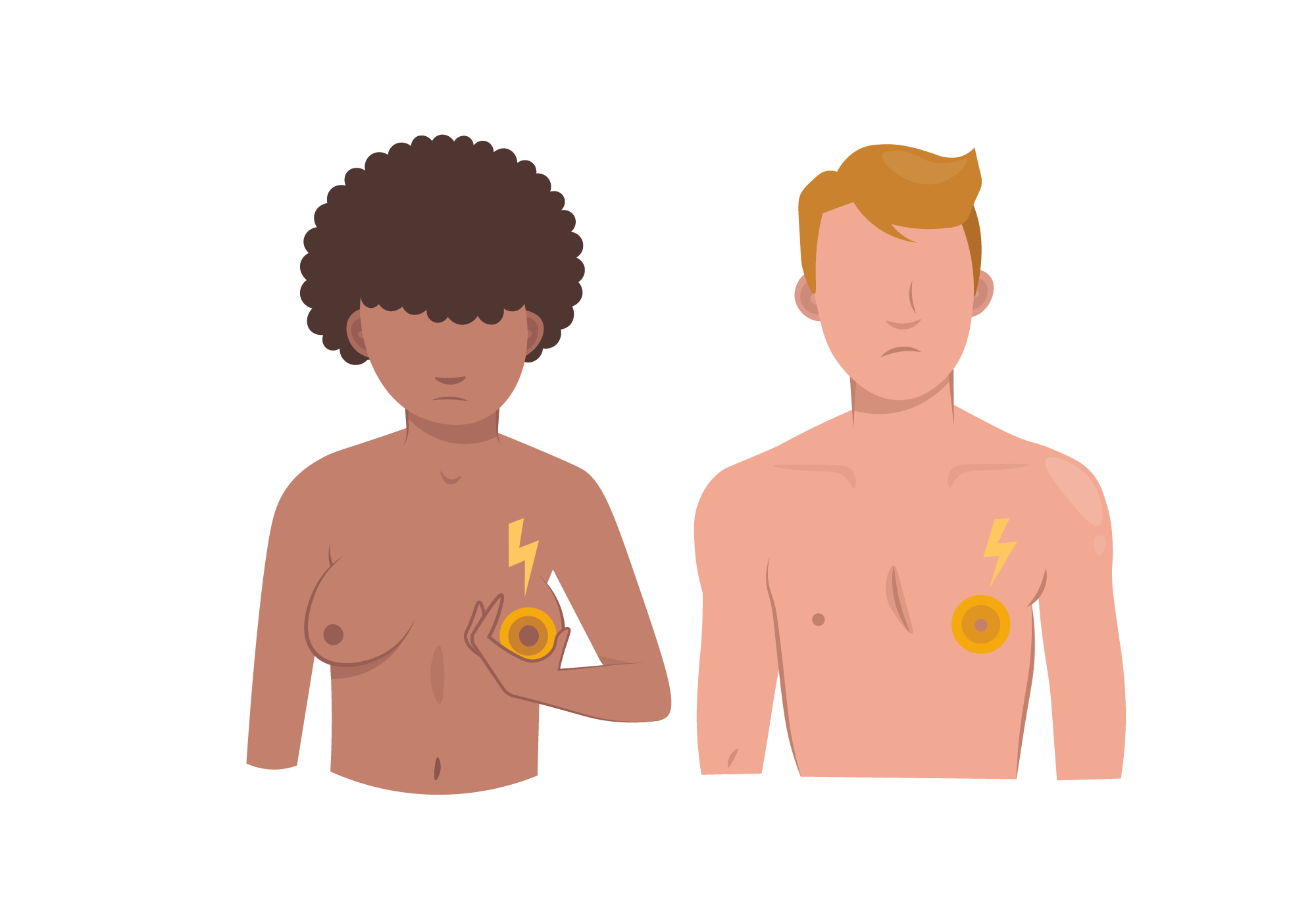 Cracked Nipples Symptoms, Causes & Common Questions