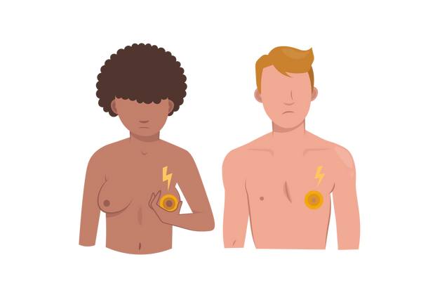 A man and a woman stand next to each other frowning. The woman on the left holds her left breast which emanates yellow concentric circles and a yellow lightning bolt. The man on the right has the same circles and lightning bolt on his left nipple.