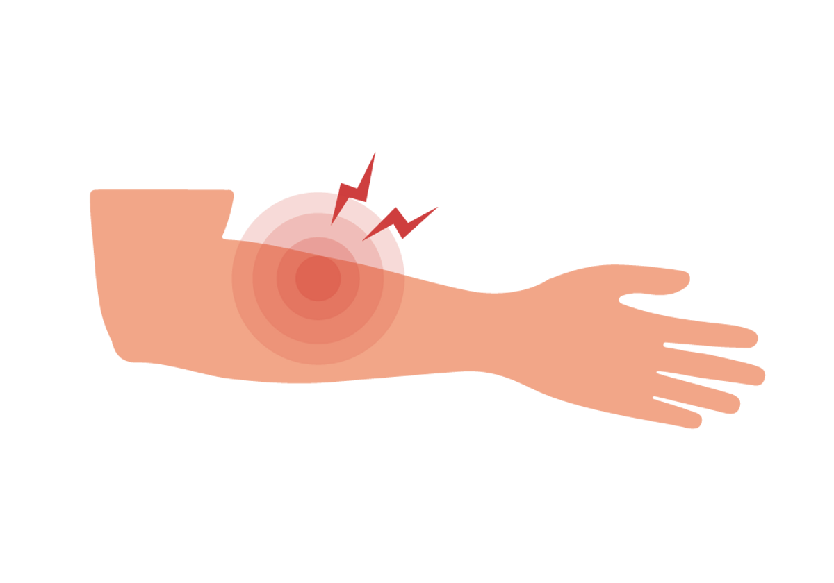 Right and Left Sided Forearm Pain Causes & Treatments | Buoy