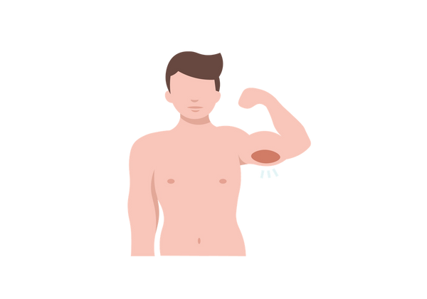 An illustration of a man with an arm raised and his triceps highlighted in red to show pain. The man is not wearing a shirt and has brown short hair.