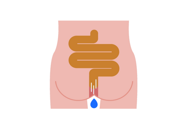Le derrière d'une personne montre un côlon brun qui devient rouge vers l'anus. Trois lignes d'action blanches se trouvent à l'intérieur du côlon et une goutte bleue coule de l'anus.
