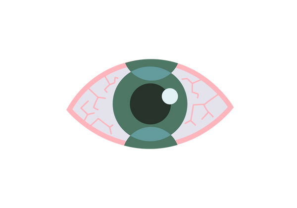 An illustration of an eye with a pink outline. Pink veins extend into the whites of the eye. The iris is medium green and the pupil is dark green. Two medium green circles overlap the iris, one on the top and one on the bottom.