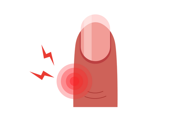 Eine Abbildung einer Fingerspitze mit einem Fleck aus roten konzentrischen Kreisen, der Schmerzen anzeigt. Von der Stelle kommen zwei rote Blitze. Der Finger hat einen mitteldunklen Pfirsichton mit einem hellrosa Fingernagel und einer French-Maniküre.