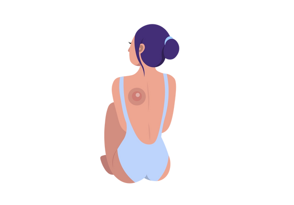 An illustration of a woman wearing a low back light blue bathing suit sitting facing away with her head turned slightly to the left. A large medium-red circle with another darker circle around it and a small lighter circle inside it is on her left shoulder blade. The rest of her skin is light-medium peach toned and her dark purple hair is tied in a loose bun with a light blue hair tie.
