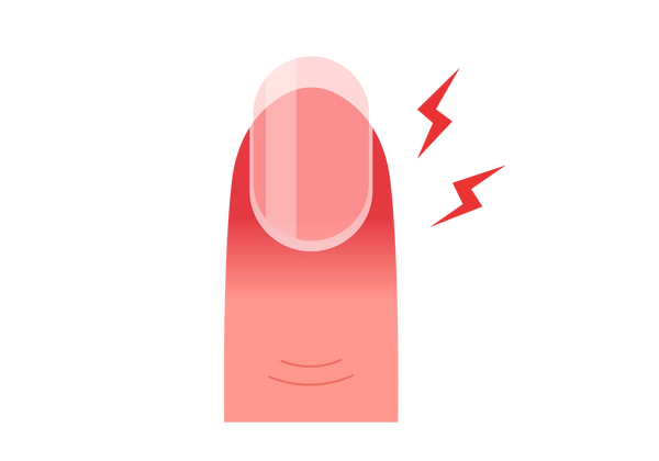 An illustration of a fingertip and nail. The skin at the tip of the finger is dark red and fades to a lighter pink closer to the knuckle. Two red lightning bolts come from the fingernail on the right side.