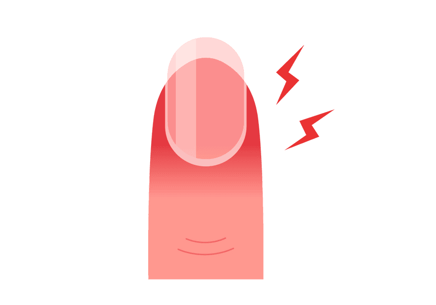 Fingernail Pain Symptoms Causes Common Questions Buoy