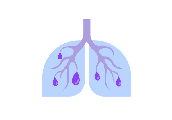 Lungs with walls filled with fluid and mucous.