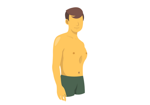 Torso of a man with a protruding chest, wearing green shorts.