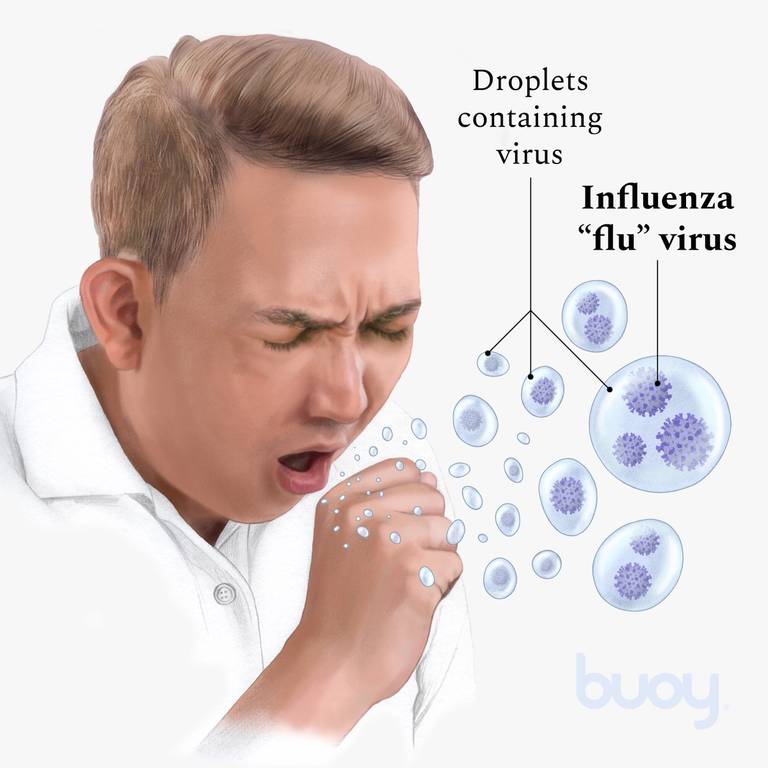 Diagnosis of Influenza