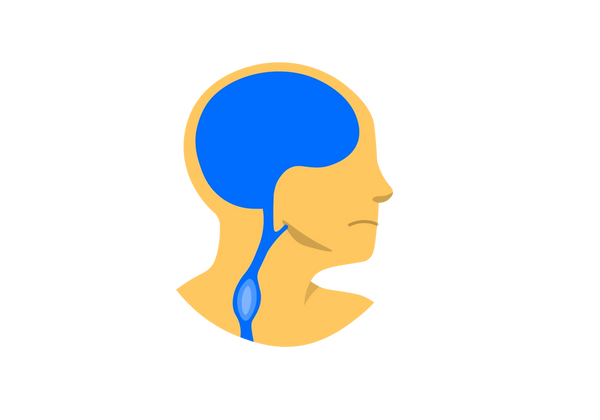 Un profil latéral de la tête jaune avec un cerveau bleu et des artères s'étendant du cerveau jusqu'au menton et au cou. Une tache bleu clair se trouve dans l’artère vers le bas du cou.