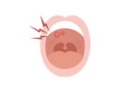 Red Spots On Roof Of Mouth And Tongue Child Development Infoupdate