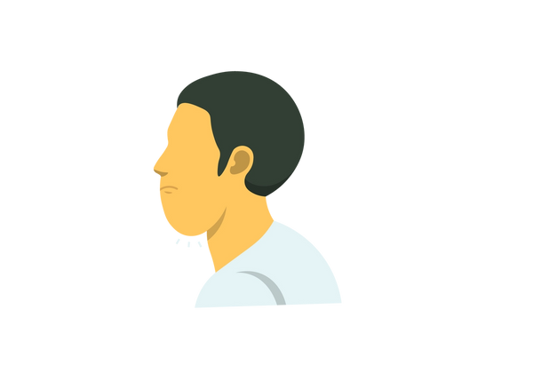 Illustration du profil latéral d’un homme au menton enflé. Il fronce les sourcils. Son menton est distendu et large et sa peau est jaune. Il a les cheveux bruns courts et porte un t-shirt vert clair.