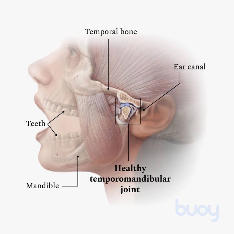 Articulação Temporomandibular - ATM - Rover Ortodontia e ATM - Cascavel