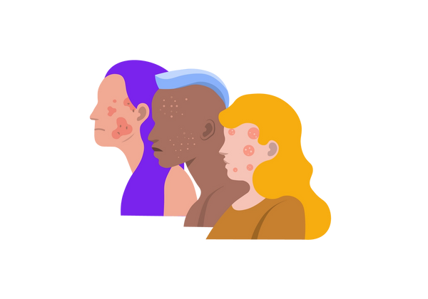 An illustration of three side profiles from the shoulders up, overlapping one another. The person furthest and leftmost has light-medium peach-toned skin with darker peach toned blotches on her cheeks and face. She is frowning and has long purple hair. The person in the middle has medium-dark warm brown skin and has lighter peach-toned spots on their face. They are frowning slightly and have a light blue short mohawk with the sides of their head shaved. The person closest and furthest right has light peach-toned skin with round darker peach splotches with lighter dots within the circles. She is frowning and has long blond curly hair and is wearing a mustard yellow shirt.