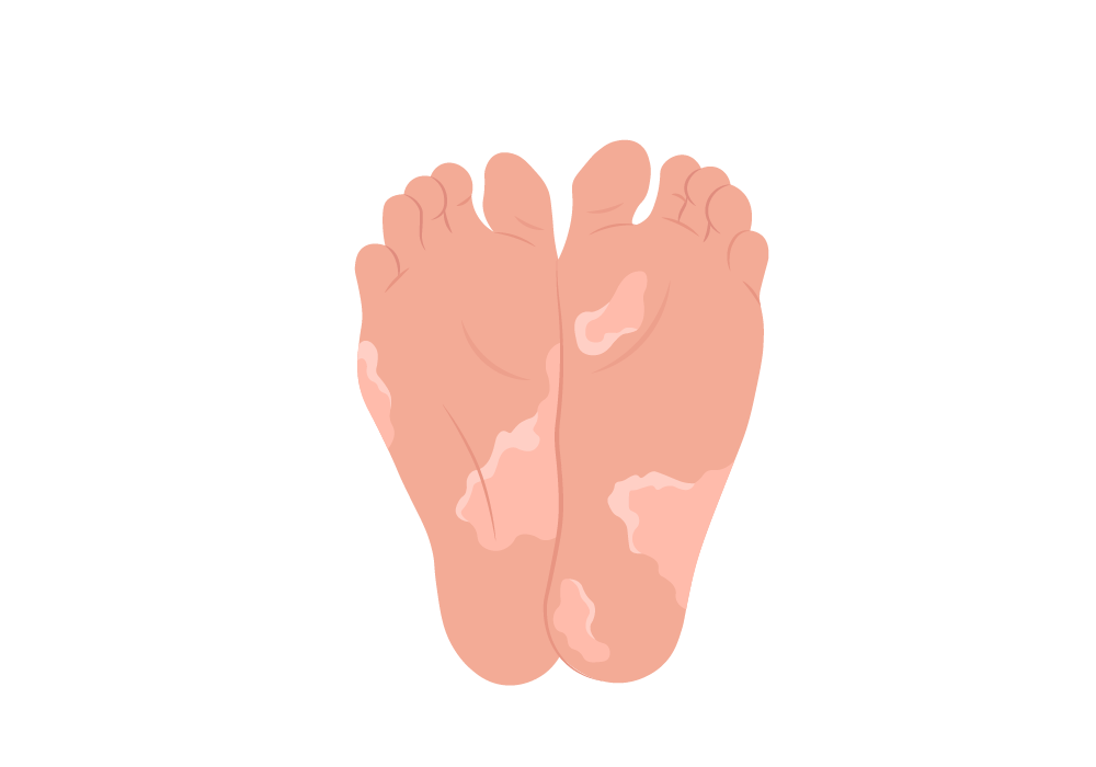 Cracked Heels & Dry Itchy feet Kit – Oz Indulgence