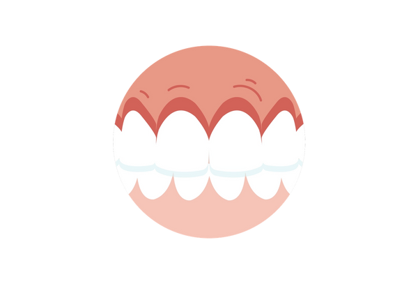 Dentes cerrados com manchas de dor nas gengivas, perto da fileira superior dos dentes.