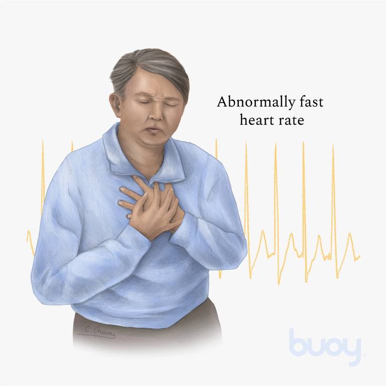 Palpitations cardiaques | Symptômes, causes et comment traiter