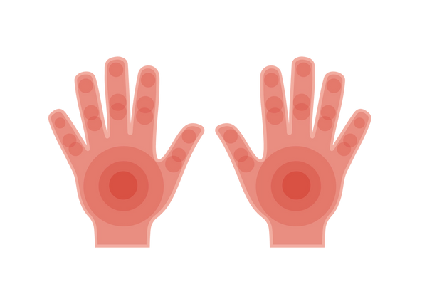 Deux mains avec des cercles concentriques rouges émanant des paumes et des jointures.