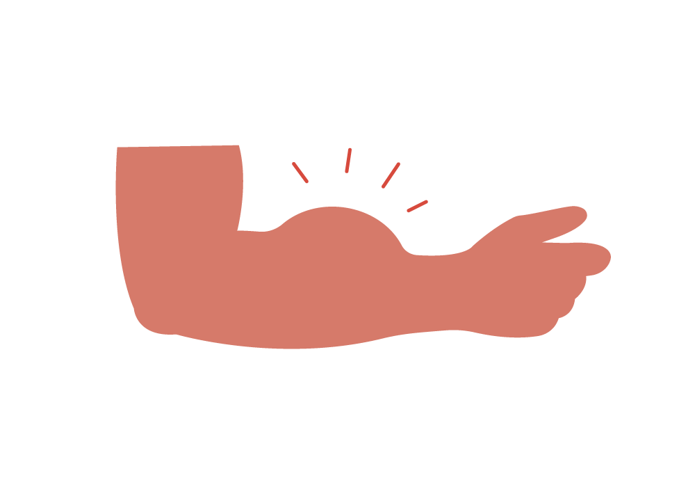 What Causes A Swollen Forearm How To Treat Forearm Swelling