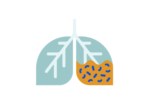 Uma ilustração representando um conjunto de pulmões verdes claros com veias verdes mais claras passando por eles. O pulmão direito apresenta líquido amarelo com linhas azuis e rabiscos preenchendo metade do pulmão.