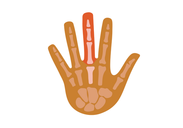 Eine Illustration einer Hand mit ausgestreckten Fingern. Der hellbraune Knochen ist durch die mittelbraune Haut sichtbar. Die Knochen im und am Mittelfinger sind in einem helleren Roséton gehalten und stärker betont. Der Mittelfinger ist leuchtend orangerot.