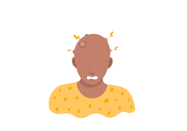 Eine Illustration einer grimassierenden Person ohne Haare und vielen Beulen auf der Kopfhaut. Von den Unebenheiten gehen gelbe Blitze aus. Die Person trägt ein gelb gepunktetes T-Shirt.