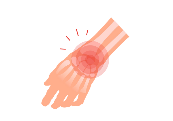 Eine Illustration einer entspannten Hand. Die Knochen sind im Handgelenk und auf der Oberseite der Hand sichtbar. Vom Handgelenk gehen rote konzentrische Kreise und vier rote Linien aus.