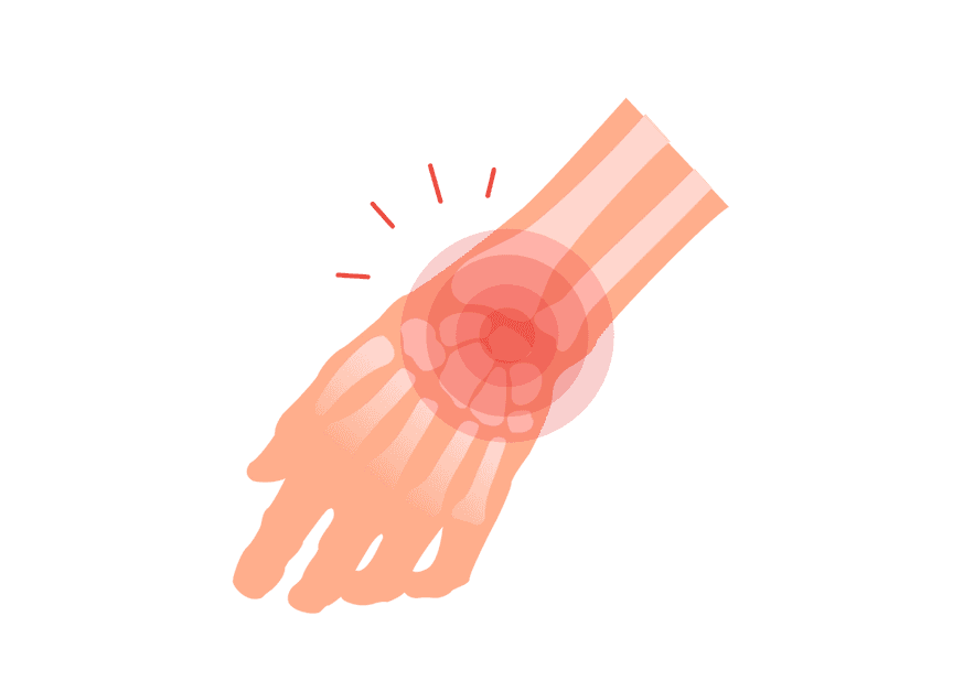 Wrist Pain 4 Causes Common Questions Buoy