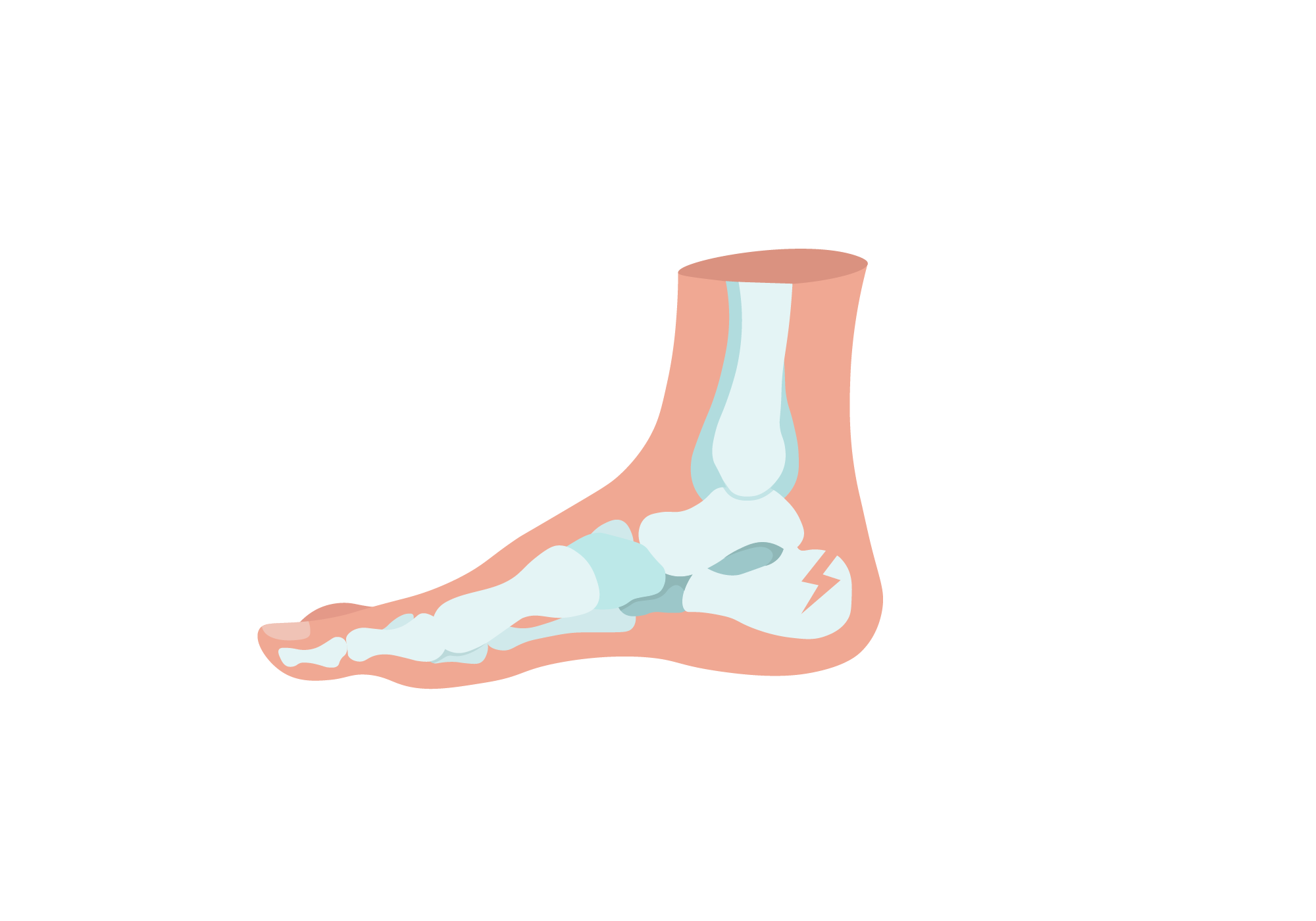 Ankle Sprain and the Road to Recovery: Arizona Foot Health: Podiatrists