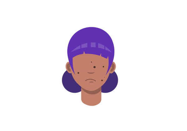 An illustration of a girl from the neck up. She has medium-dark peach-toned skin with dark brown round circles speckling her frowning face. Her purple hair is cut into messy bangs and fringe and is tied in two low buns on the back of her head.