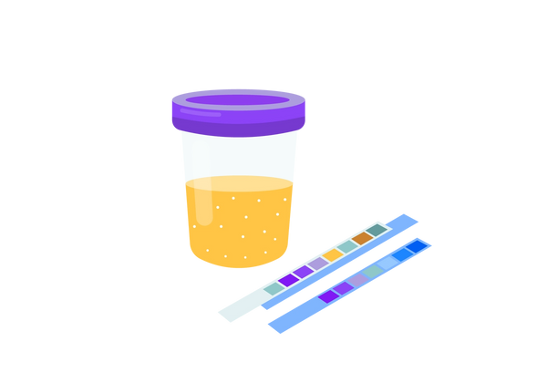 A sample cup with a purple lid filled with yellow liquid. Two blue strips with different colored squares lie to the right of it.