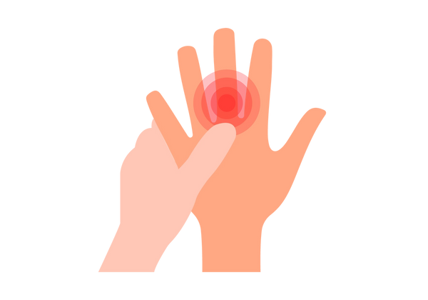Una ilustración de una mano con los dedos extendidos. La piel es de tono melocotón medio y una segunda mano, un poco más clara, sostiene el nudillo del dedo medio de la primera mano. Los círculos concéntricos rojos provienen de un punto cercano al nudillo de la mano y muestran dolor.
