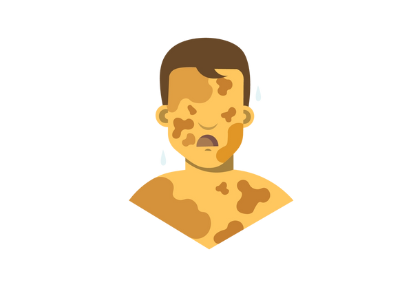 An illustration of a boy from the chest up facing forwards. His yellow skin is covered in darker yellow-brown blotches. Two blue drops are next to his head, one on each side. His mouth is open and frowning and he has short dark brown hair.