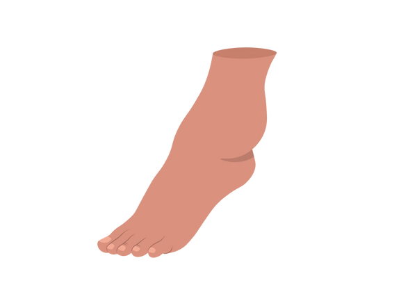 Uma ilustração de um pé e tornozelo em tom pêssego médio-escuro. O tornozelo tem uma grande protuberância na parte externa. As unhas dos pés têm um tom ligeiramente mais claro que o tom da pele.