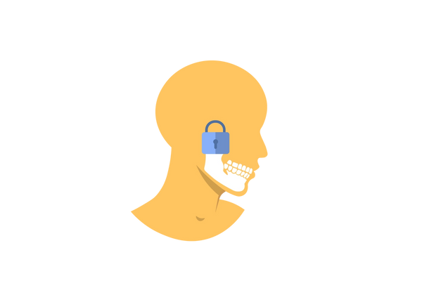Illustration d’un profil latéral de la tête d’une personne. L'os de la mâchoire et les dents sont blancs et visibles sur la peau jaune. Un verrou se trouve au niveau de l’articulation de la mâchoire.