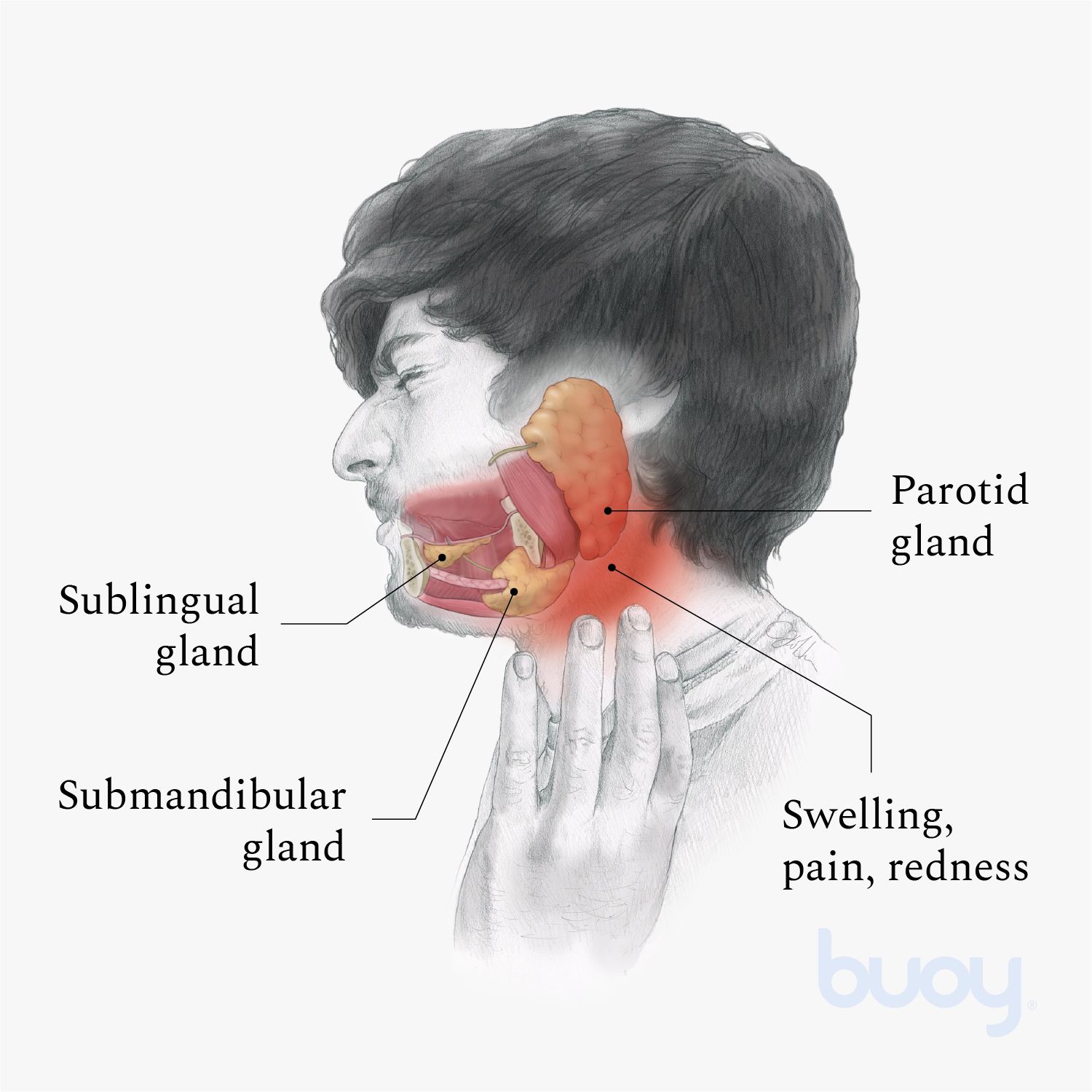 Sialadenitis | Symptoms of Salivary Gland Disorder and How to Treat