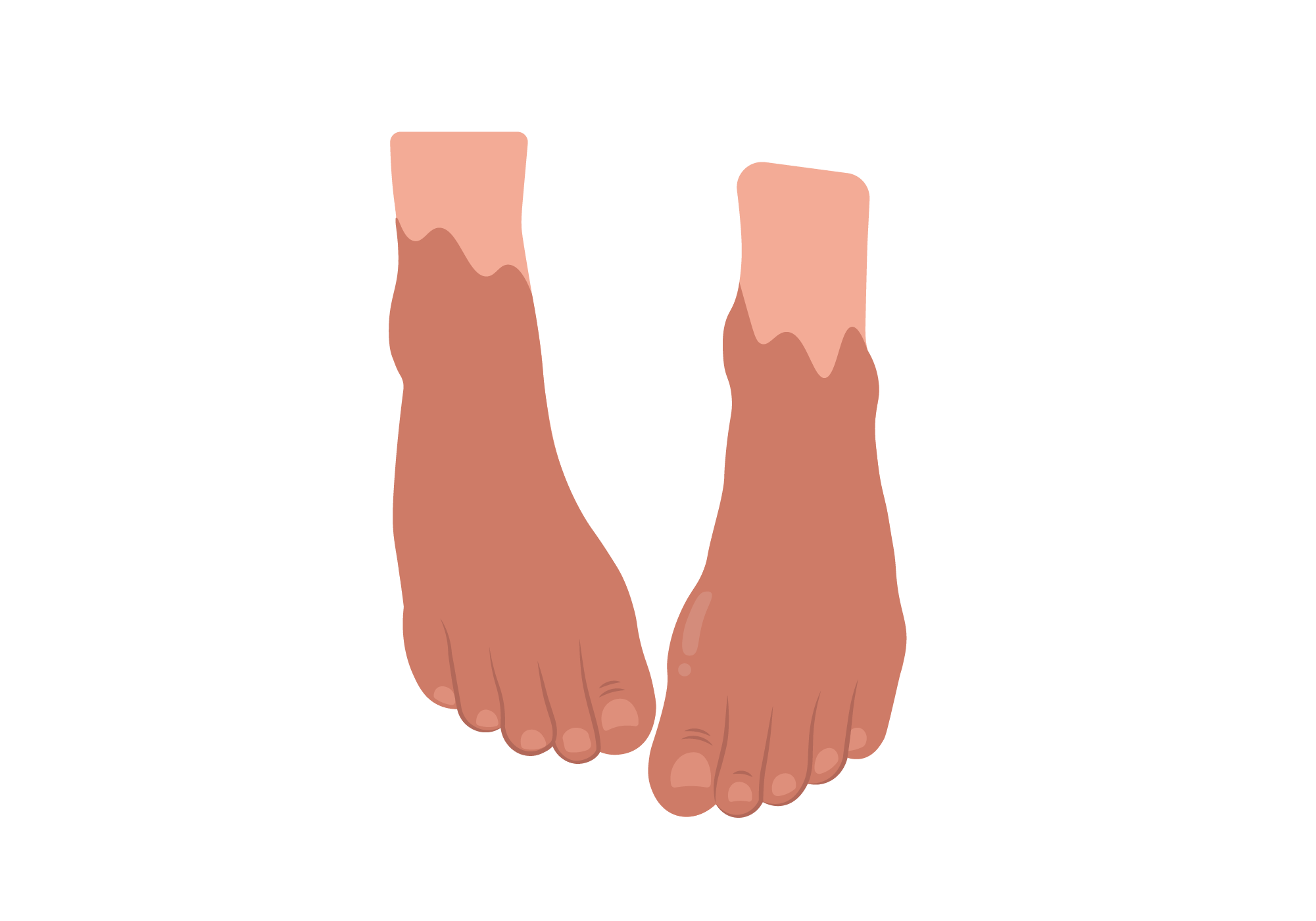 Why Your Pinky Toe is Numb | 5 Pinky Toe Numbness Reasons
