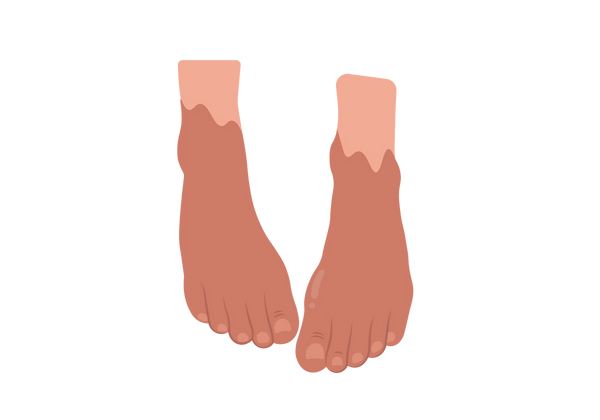 An illustration of two feet from a partial top-down view. The ankles are light peach-tone, and the feet are a darker shade of peachy-red.