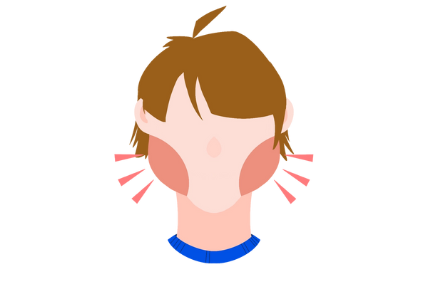 An illustration of a little boy from the neck up. His cheeks are bright red and swollen. Three bright red triangles come from his cheeks on each side to emphasize the swelling. The boy has otherwise light peach skin and medium brown short messy hair. The collar of his shirt is dark blue.