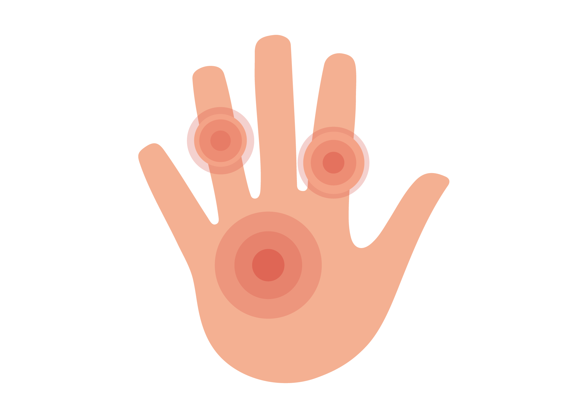 Top 11 Causes of Hand Swelling | Buoy