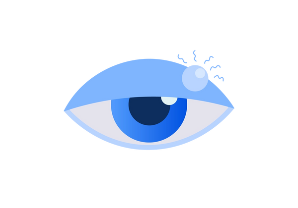 Ilustração de um olho com uma pálpebra azul clara semifechada. Um caroço azul mais claro está à direita da pálpebra. Cinco rabiscos azuis emanam do caroço. A íris é azul média e a pupila é azul escura.