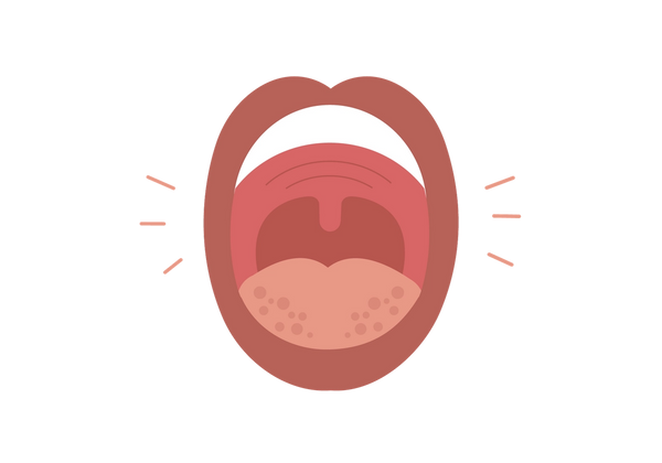 A swollen mouth that is opened.